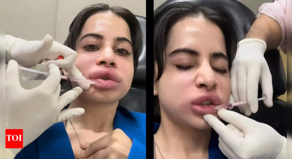 Lip fillers gone wrong or normal side effect? Expert breaks down Uorfi Javed’s swollen lips