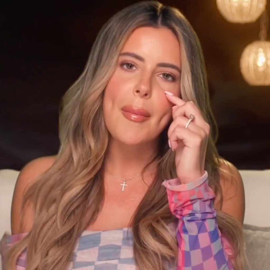 Brielle Biermann's New Look After Dissolving Eye Filler
