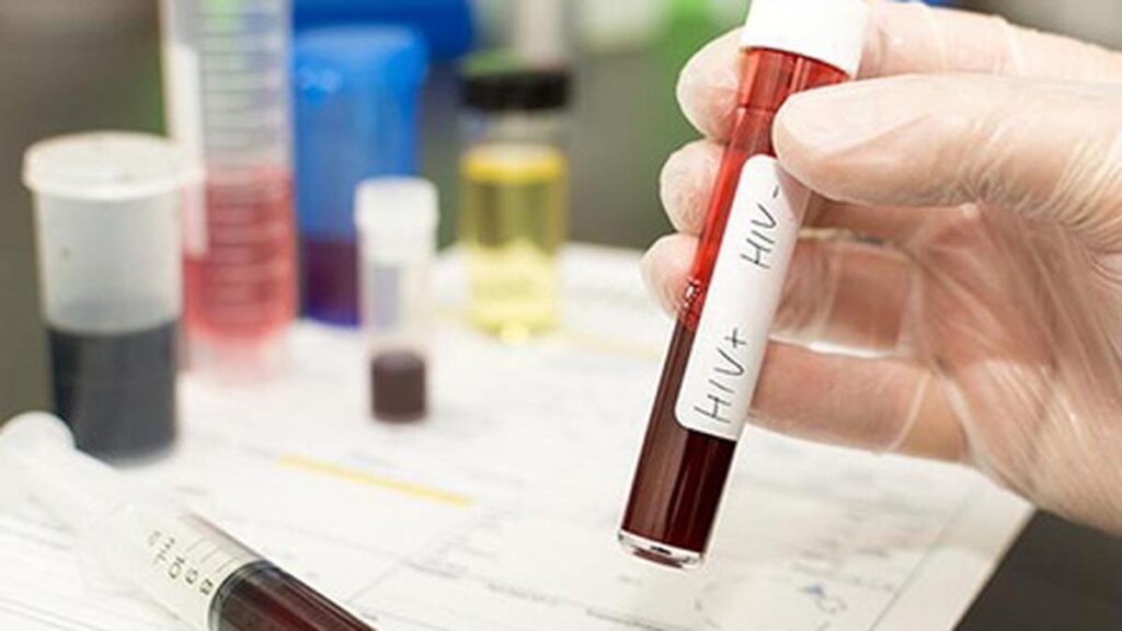 US aid cuts halt HIV vaccine research in South Africa, with global impact