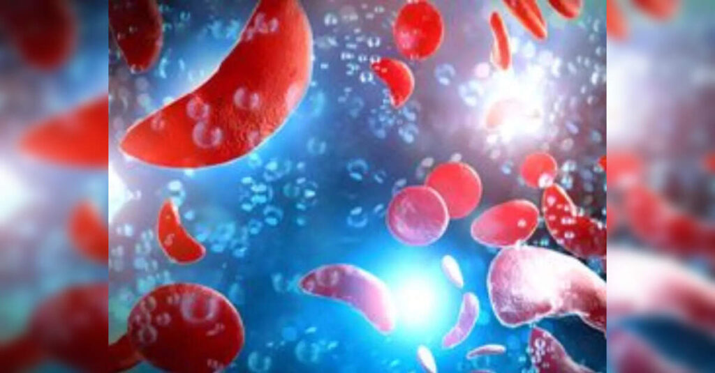 Fulcrum stock slumps after muscle disorder drug fails in late-stage study, ETHealthworld