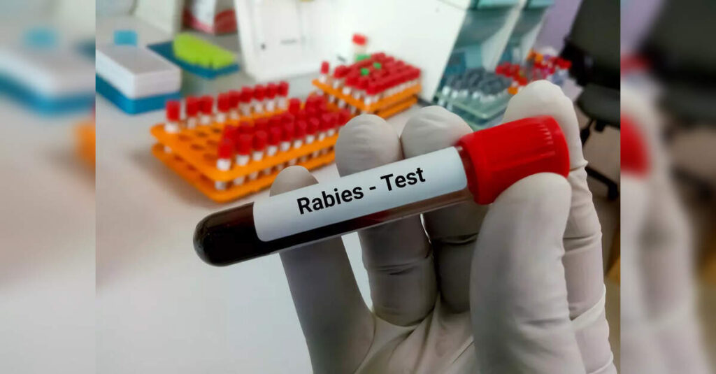 Karnataka Faces Alarming Surge in Dog Bite Cases and Rabies Deaths, ETHealthworld