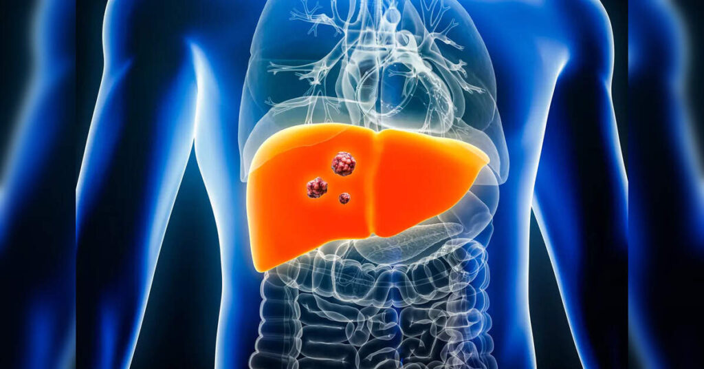 Major Preventable Causes Identified, ETHealthworld