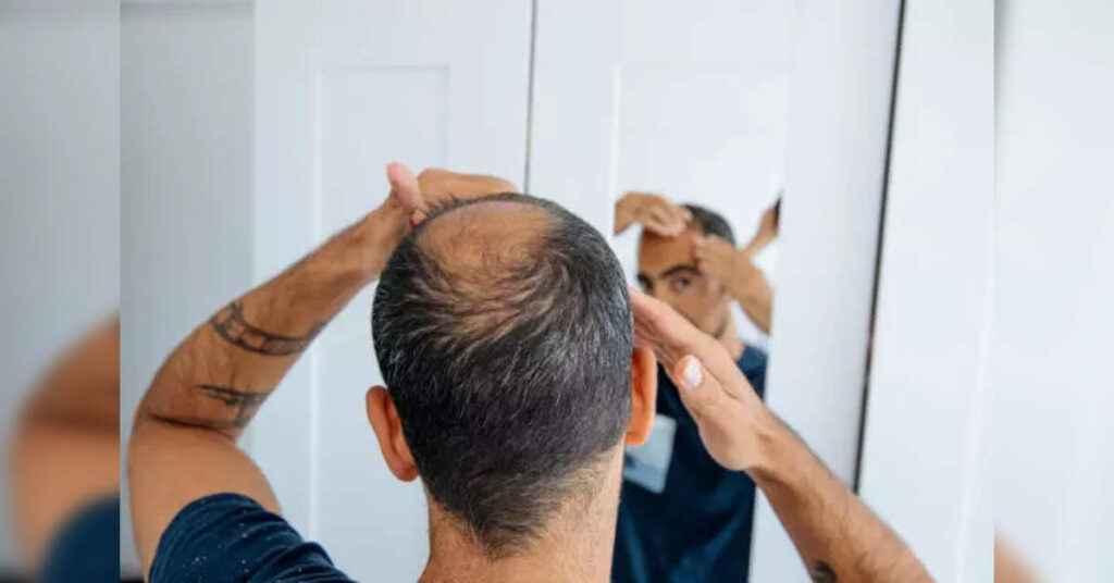 Revolutionary Molecular Approach Paves Way for Hair Regrowth Without Transplant Surgeries, ETHealthworld