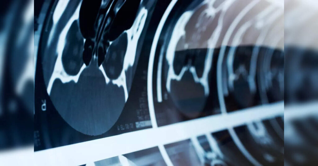 Unusual Diagnosis of Rare Subcutaneous Tailgut Cyst in 37-Year-Old Woman by Redcliffe Labs, ETHealthworld