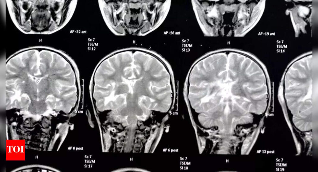 THIS silent threat around is eating away at the brain, even increasing the risk of dementia |