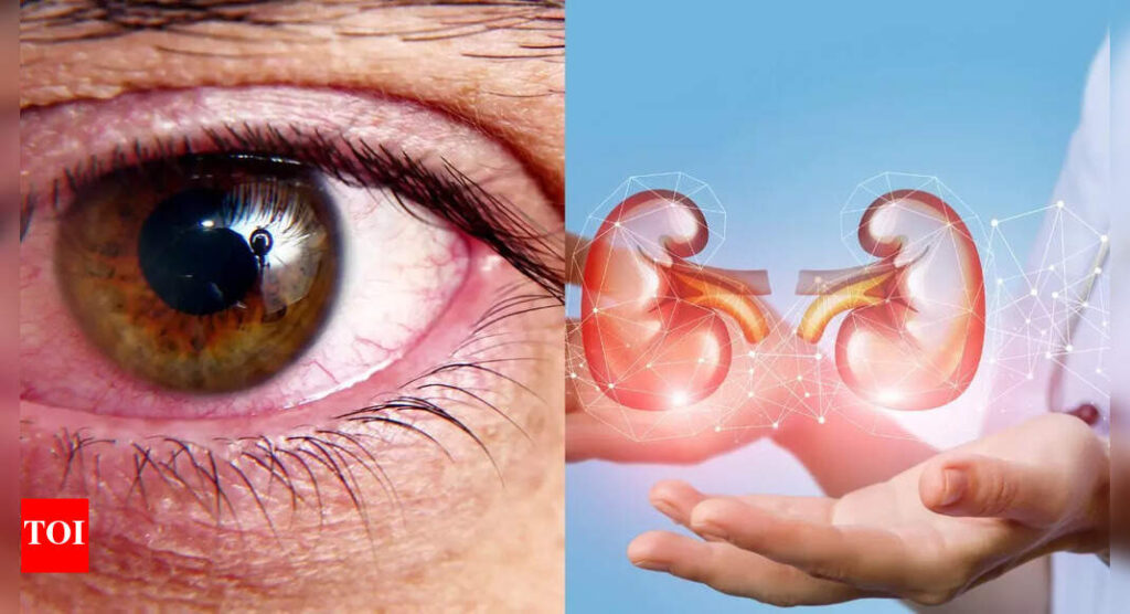 Don’t ignore these 5 eye symptoms, as they could point to kidney disease |