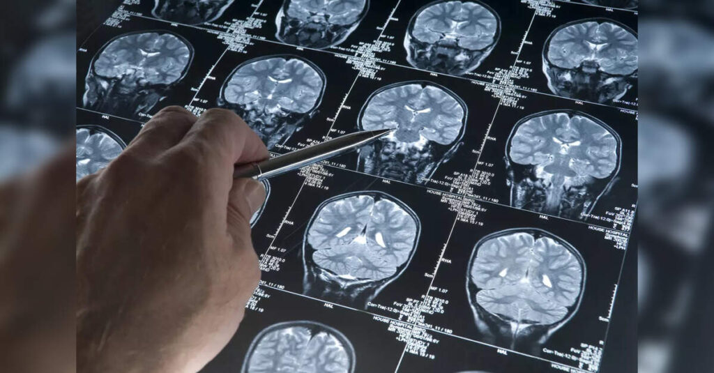 KGMU Launches Groundbreaking Study on Brain Diseases, ETHealthworld