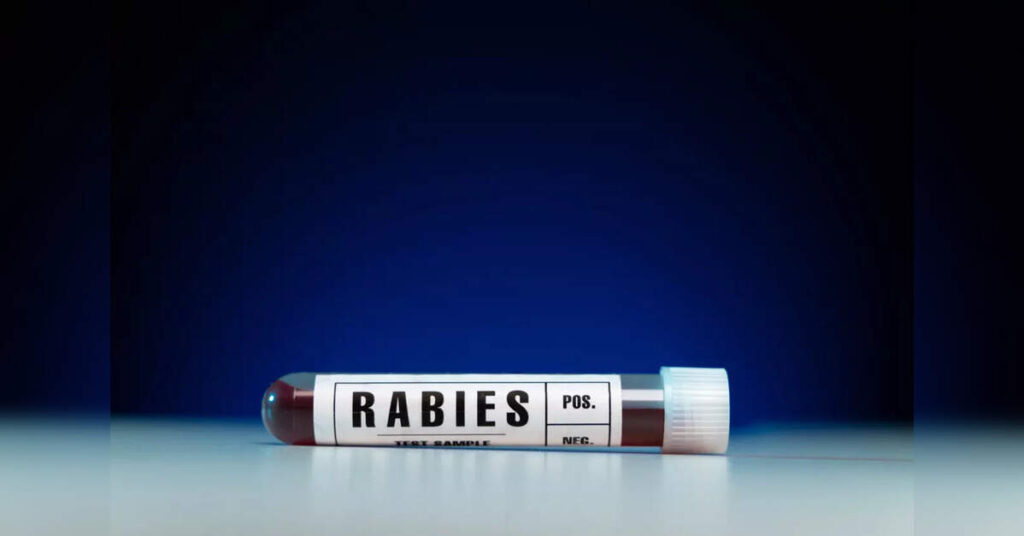 Nationwide Survey Reveals Alarming RIG Shortage in Public Health Facilities for Rabies Treatment, ETHealthworld