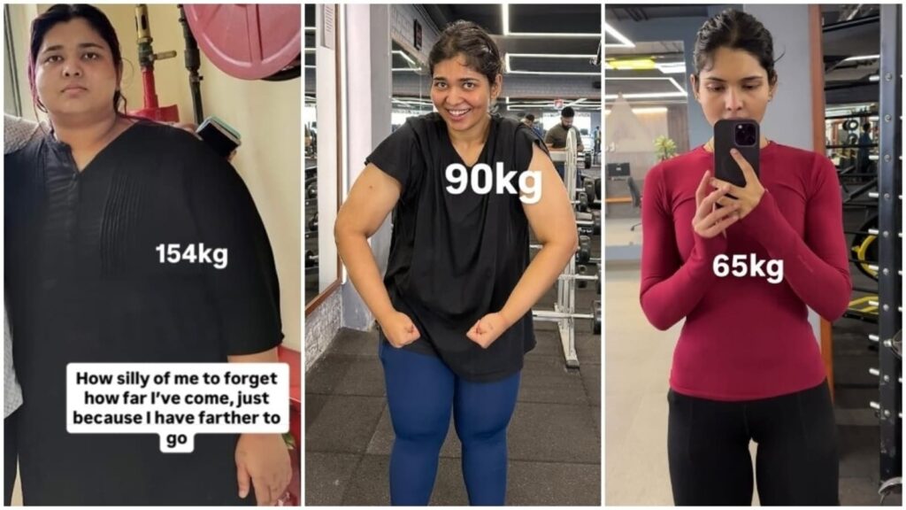 Woman who lost 89 kg shares why she still doesn't feel healthy: ‘Bloating, migraines, no periods in 6 months' | Health