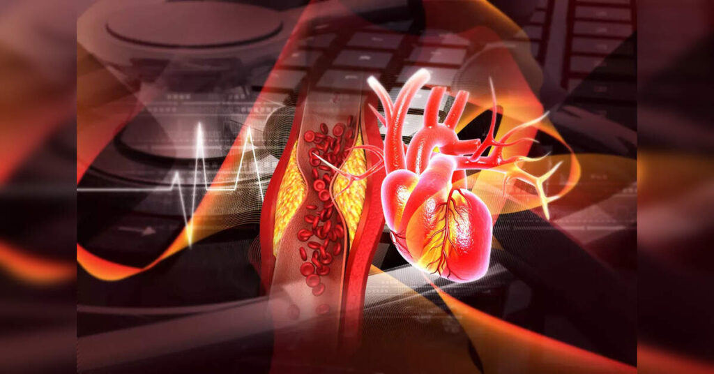 1 in 4 Indians May Face Heart Disease Risk Due to Abnormal Cholesterol: Metropolis Study, ETHealthworld