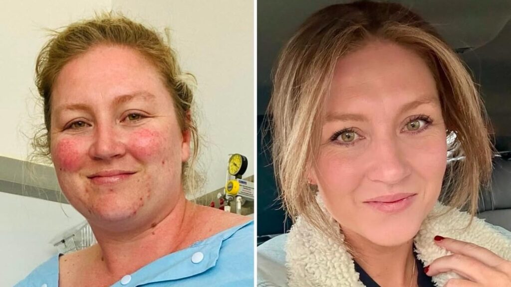 Woman who lost 70+ kgs shares 5 daily habits that helped her lose weight and keep it off: ‘The real challenge was…’