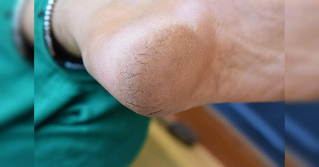 What your body is trying to tell you and how to stop them for good, ETHealthworld