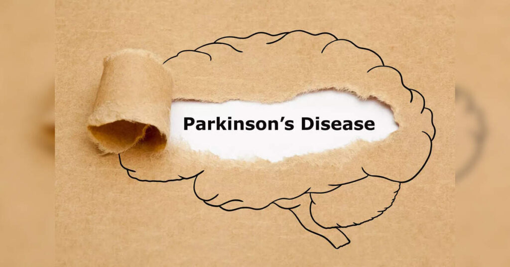 Cycling as a Neuroprotective Activity for Parkinson’s Disease Patients, ETHealthworld