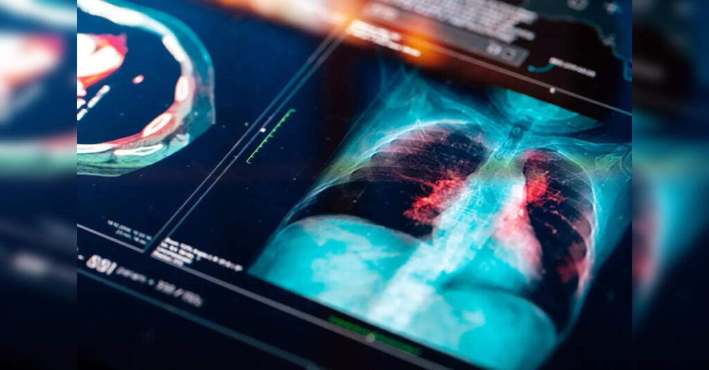 India's Youth Faces Respiratory Crisis as Lung Health Declines, ETHealthworld