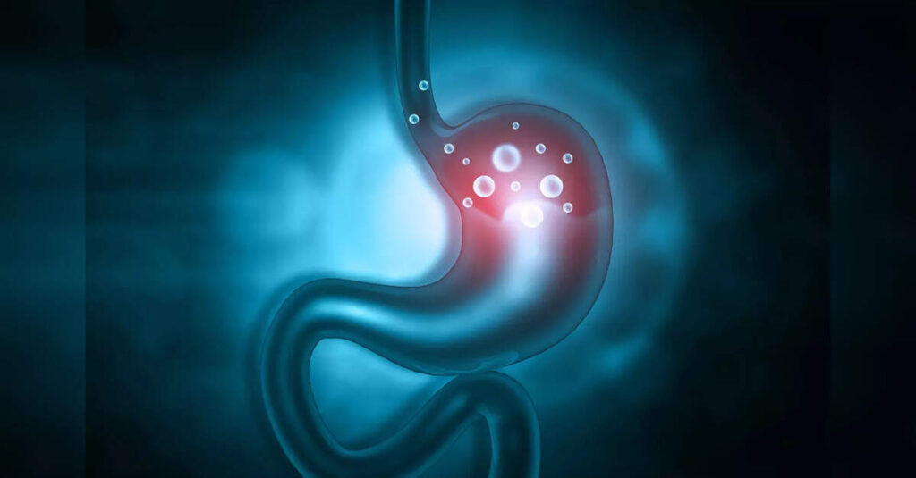 Johnson & Johnson Withdraws LINX Acid Reflux Device from Global Markets, ETHealthworld