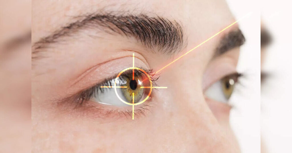Laser surgery safe for nearsighted teens, study shows, ETHealthworld