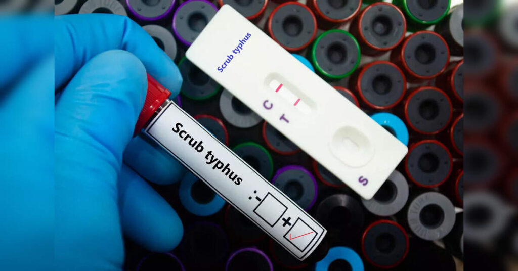 Mizoram health official warns of scrub typhus spreading across state, ETHealthworld