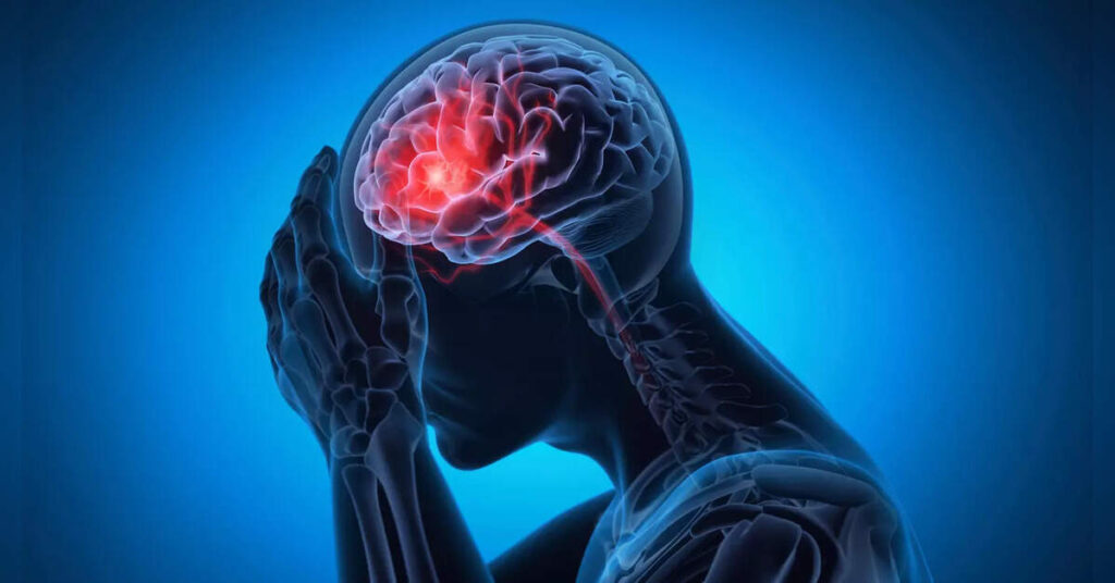 Spike in brain strokes among 40s and 50s, say doctors; stress timely diagnosis, ETHealthworld