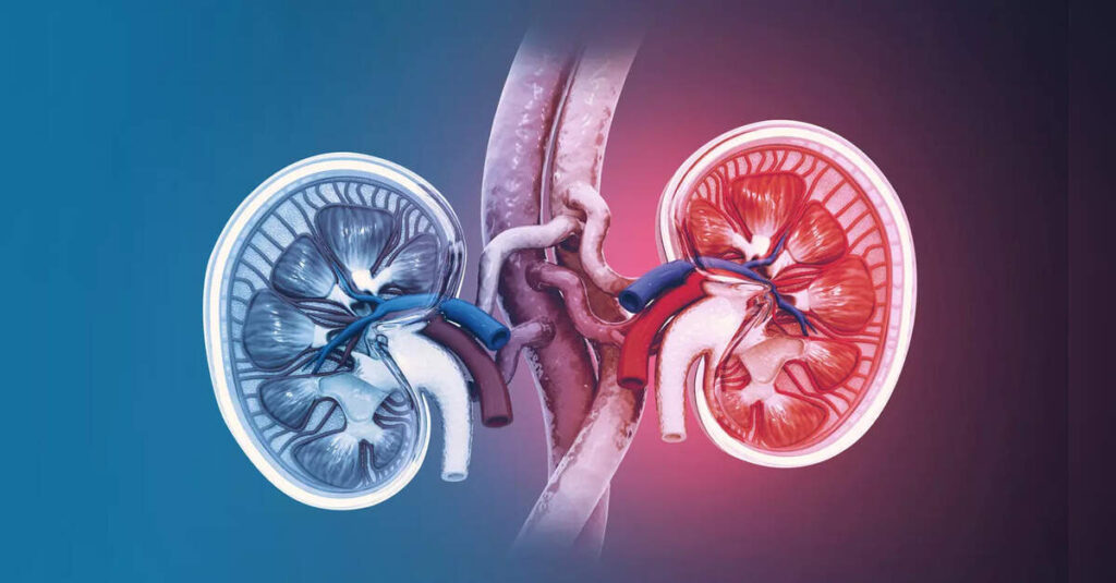 Study projects kidney cancer cases could double in next 25 years globally, ETHealthworld