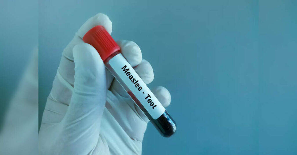 Tragic Death of LA County Child Highlights Risks of Measles Complications, ETHealthworld