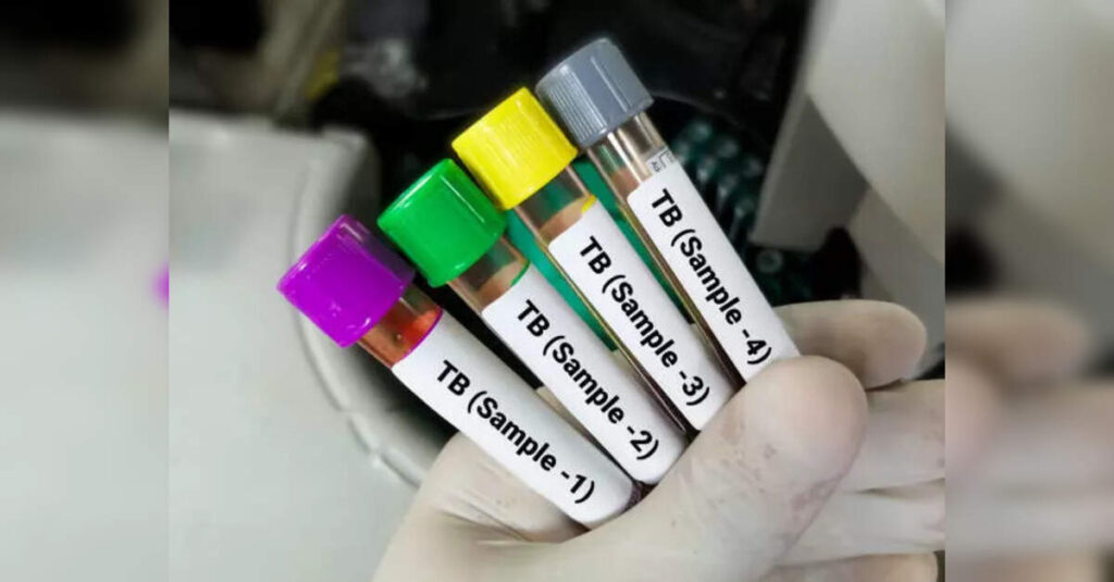 Gujarat leads TB elimination efforts with groundbreaking Nikshay Mitra initiative, ETHealthworld