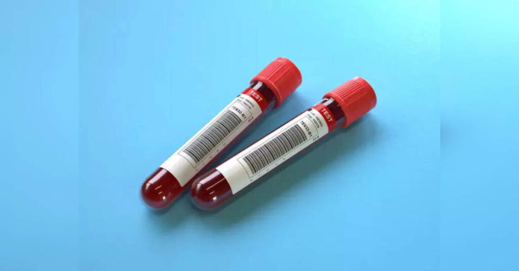 Scientists successfully convert kidney blood type in groundbreaking transplant procedure, ETHealthworld