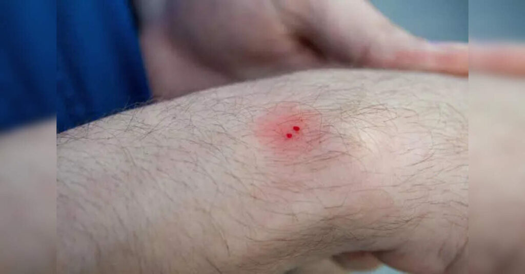 Kerala declares snakebite envenomation a disease of public health importance, ETHealthworld