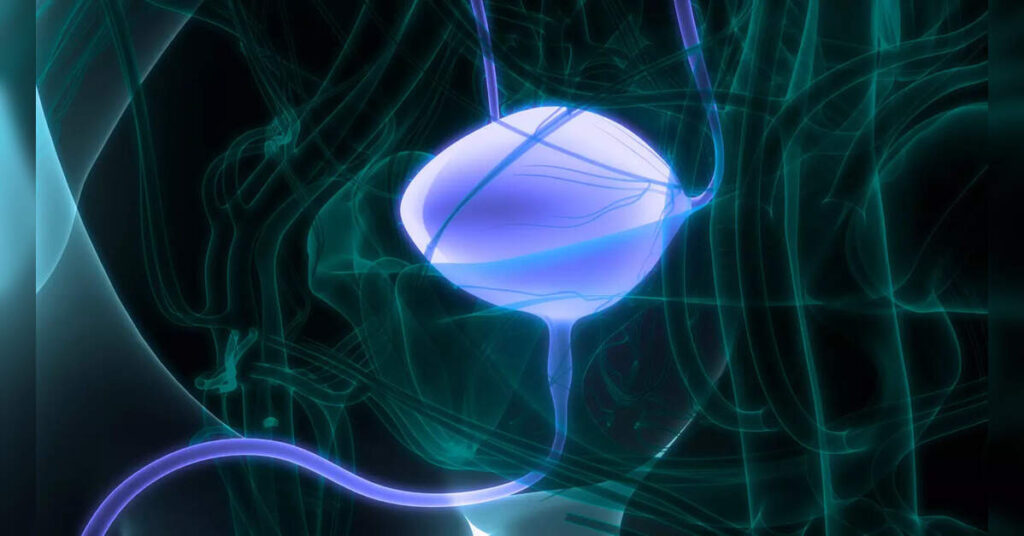 Radiation therapy reduces risk of pelvic relapse in bladder cancer patients: study, ETHealthworld