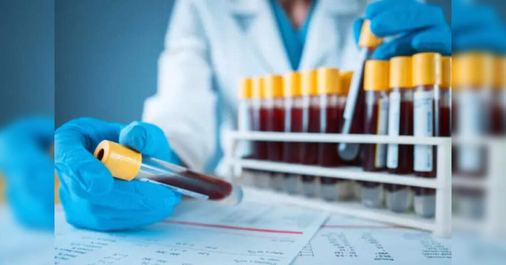 Roche and Eli Lilly's Blood Test for Alzheimer's Diagnosis Receives US Approval, ETHealthworld