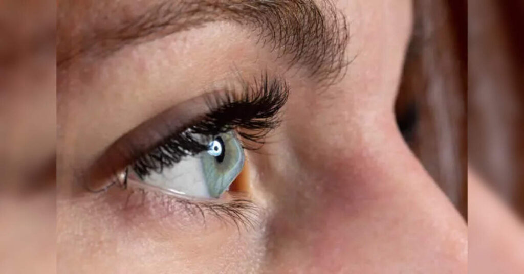 Severity of keratoconus predecits risk of disease progression even after treatment: Study, ETHealthworld