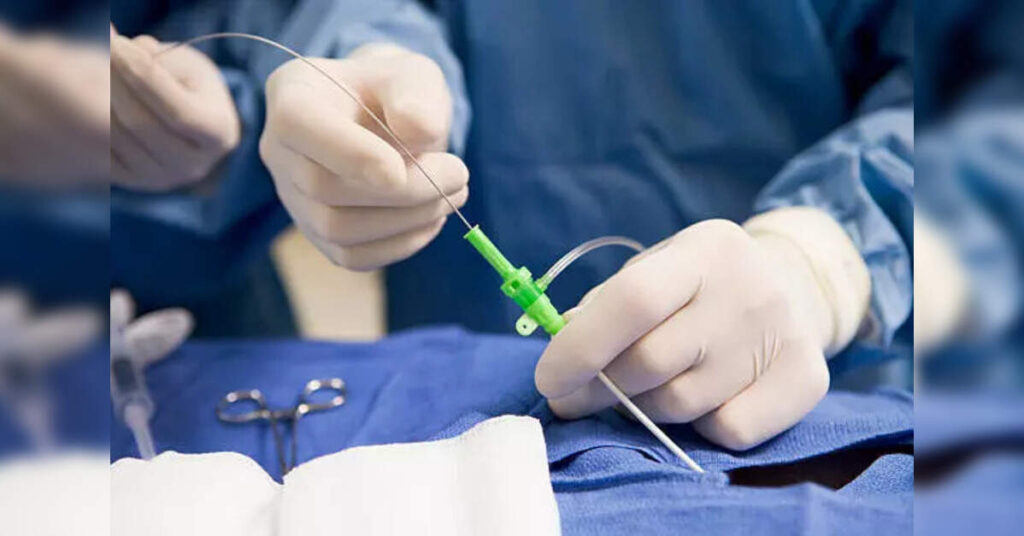 Terumo launches FineCross M3 Coronary Micro-Guide Catheter in India, ETHealthworld